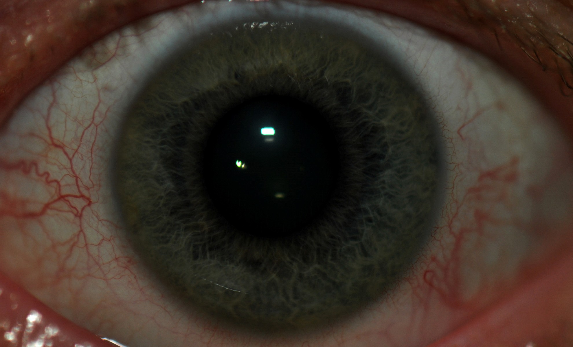 consult_iridology_left.jpg