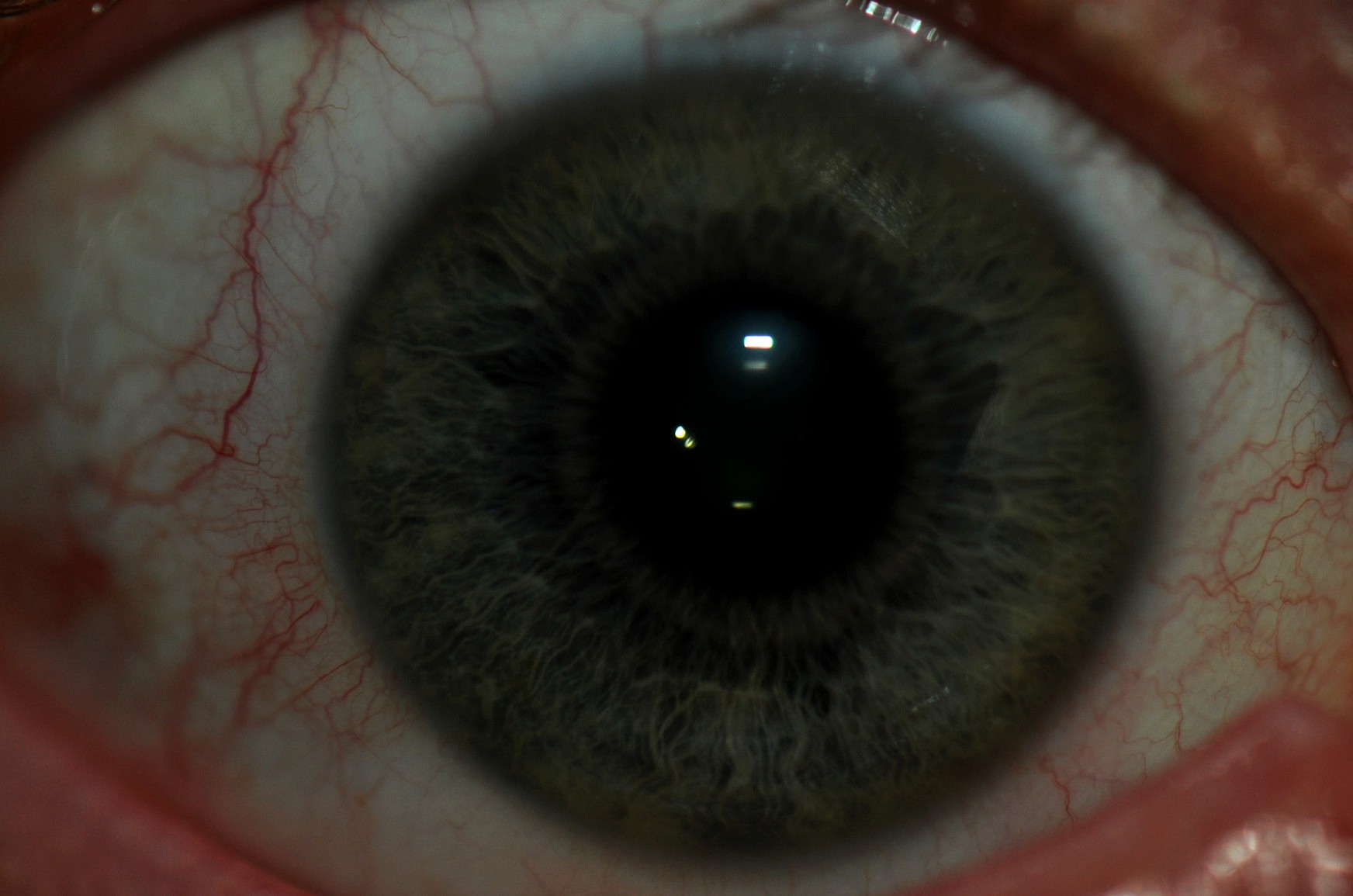 consult_iridology_right.jpg