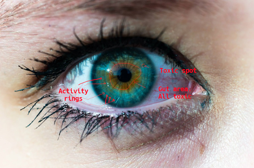 iridology_exampleiris.jpg