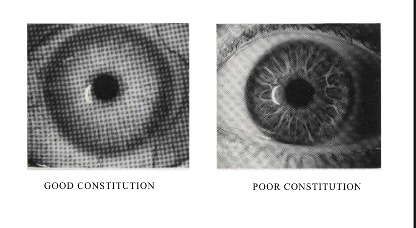 iridology_goodvspoor.png