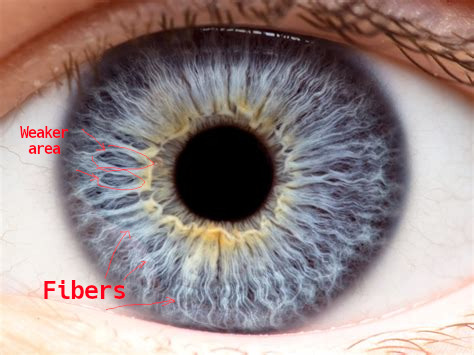 iridology_irisfibers.jpg